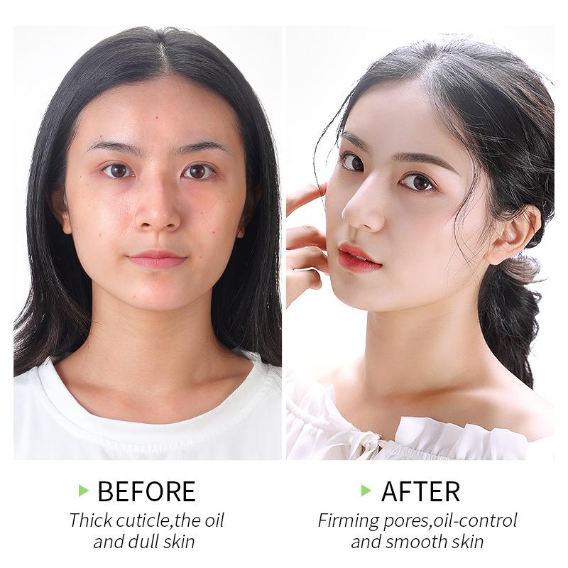 Peeling Esfoliante de Matchá! - Boutique da Beleza
