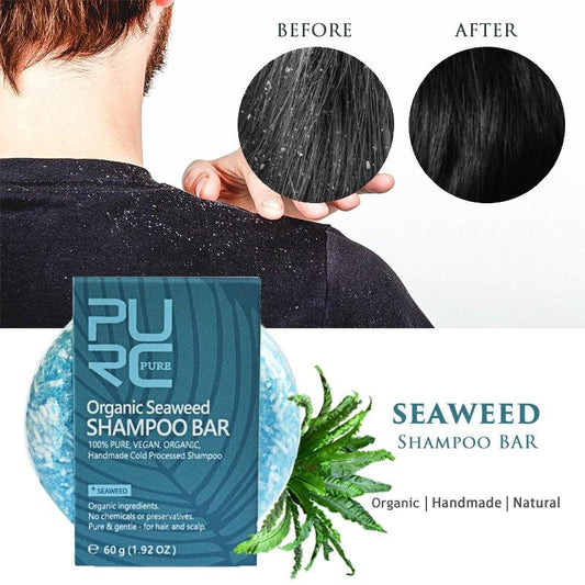 Shampoo em Barra - Anti-Caspa - Natural, Vegano & Orgânico! - Boutique da Beleza
